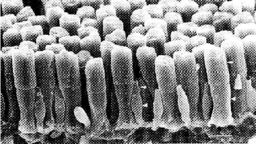retinaem.jpg