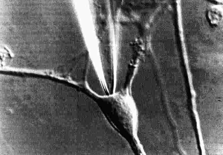 neuronl.jpg