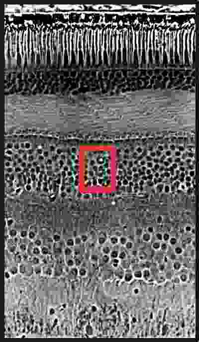 retinal.jpg