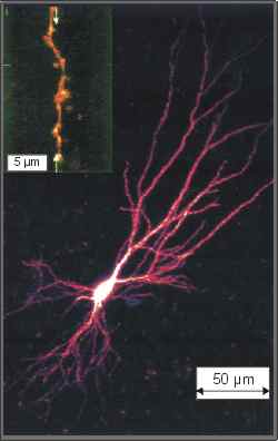 neuron2l.jpg
